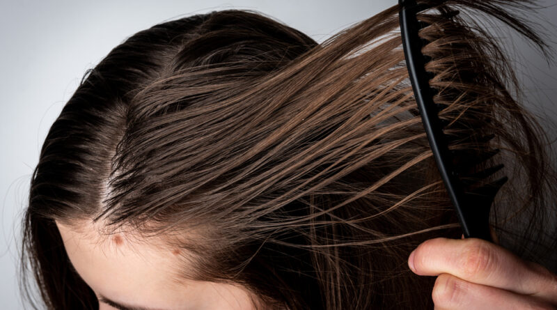 Fettige Strähnige Haare