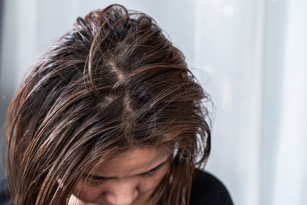 Ungepflegte Haare