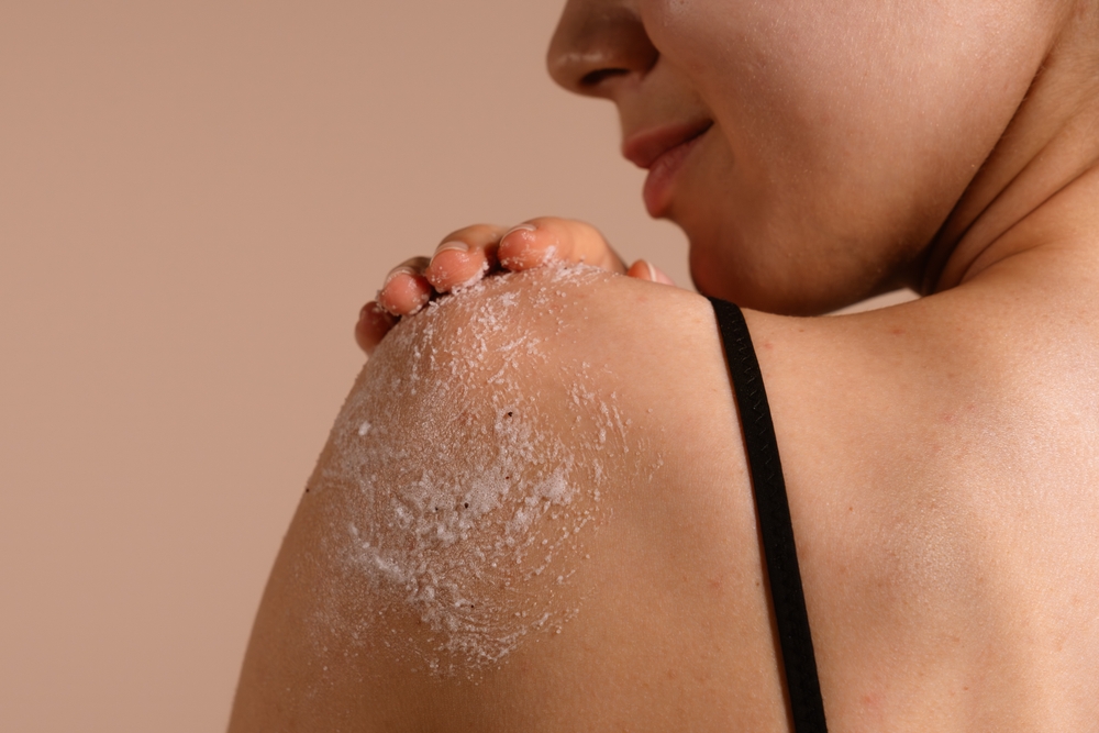 Peeling der Haut